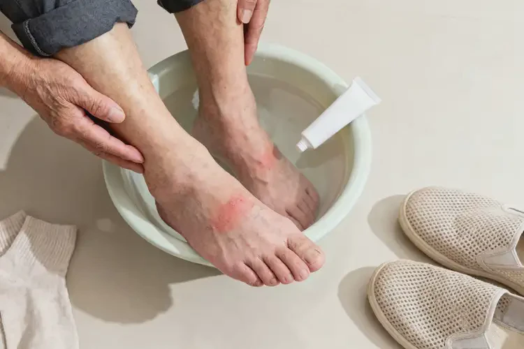 老年人腳上偶爾起濕疹能靠自己自愈嗎(圖1)