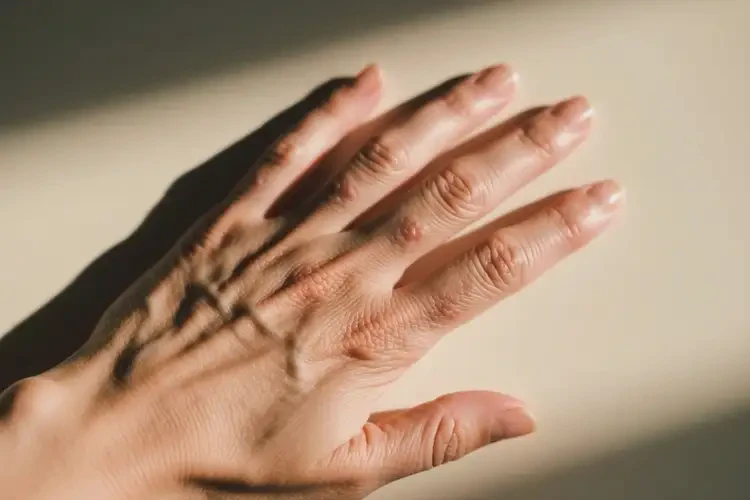 女人手上有濕疹不管它會(huì)自己好嗎(圖2)