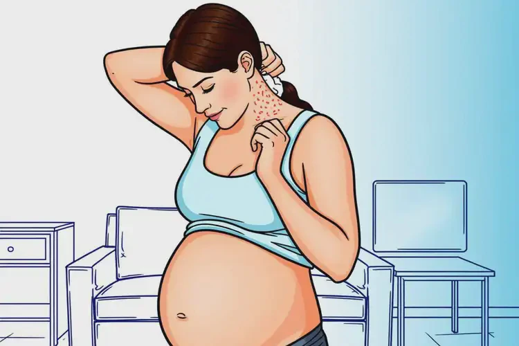 产妇脖子起湿疹可不可以彻底自愈(图1)