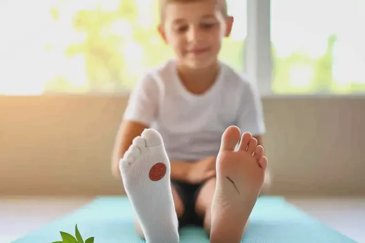 中學(xué)生腳上長(zhǎng)濕疹能不能徹底自愈(圖4)