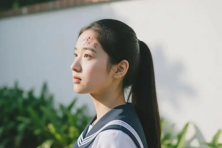 中學(xué)生臉上出現(xiàn)濕疹不管它會自己痊愈嗎(圖2)