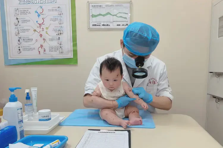 寶寶四肢經(jīng)常長濕疹可以徹底自愈嗎(圖2)