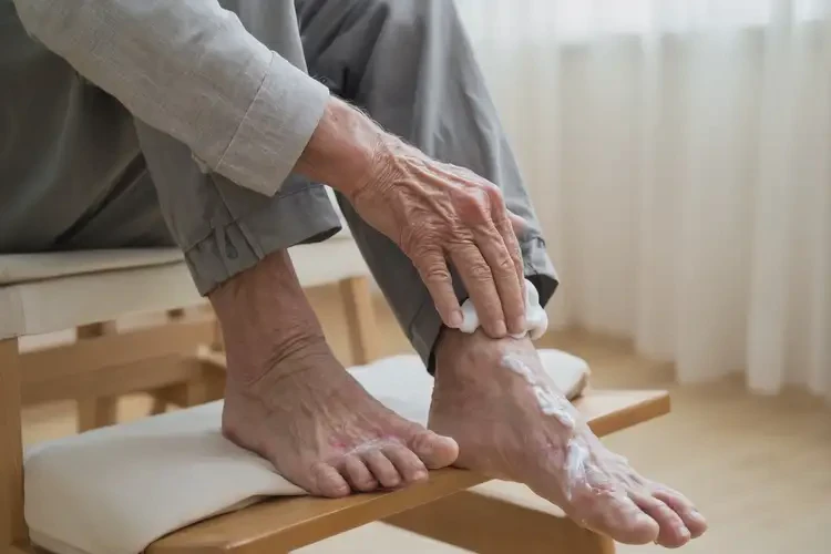 老年人腳上出現(xiàn)濕疹不管它會自己好嗎(圖3)