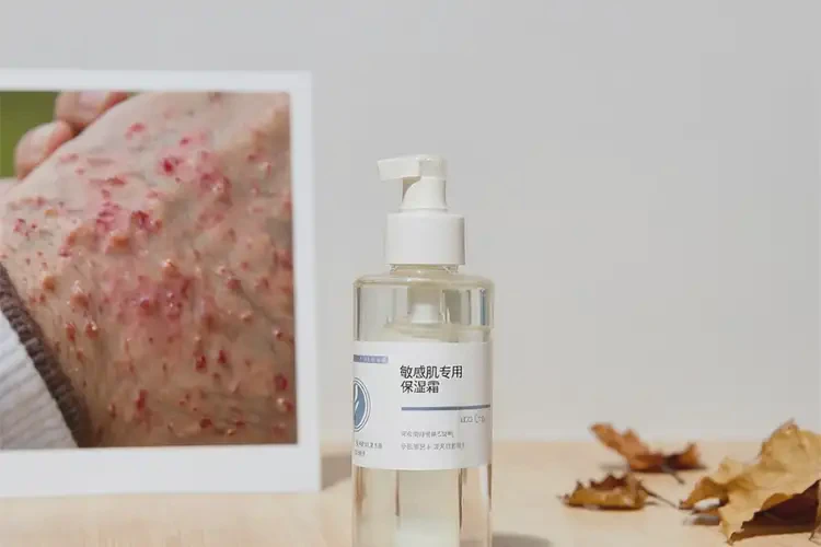 男人手上容易起濕疹不管它會自己自愈嗎(圖3)