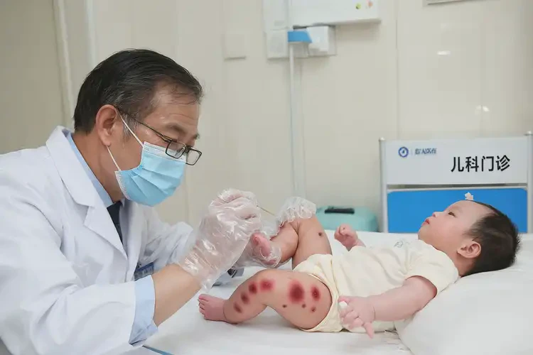 婴儿大腿上容易长湿疹能够彻底治愈吗(图3)