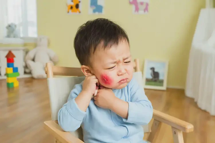 幼兒脖子長濕疹不管它會自己好嗎(圖2)