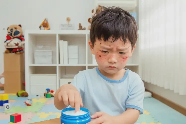 小兒面部出濕疹能靠自己自愈嗎(圖2)