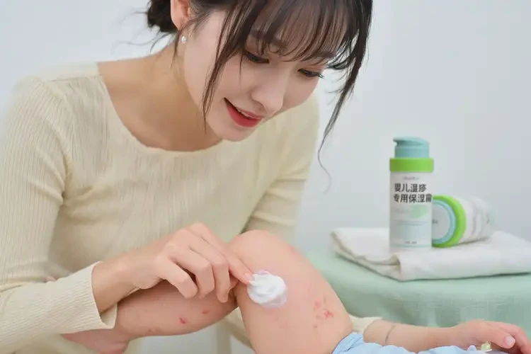 新生兒小腿上出濕疹不管它會(huì)自己好嗎(圖3)