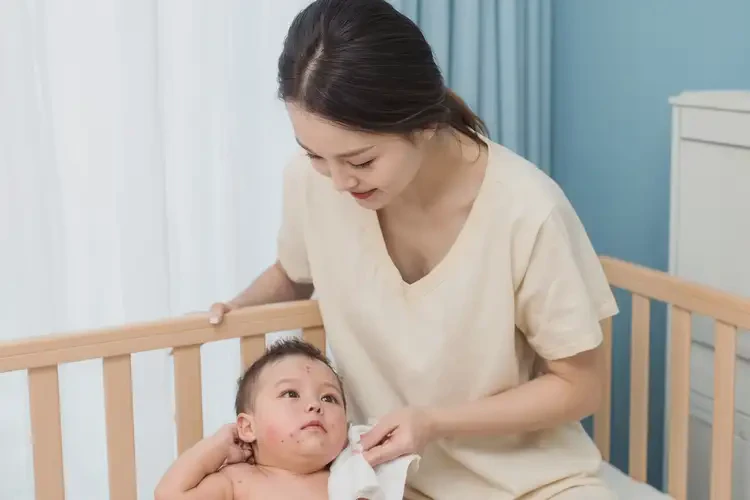 新生兒脖子上偶爾起濕疹能徹底自愈嗎(圖3)