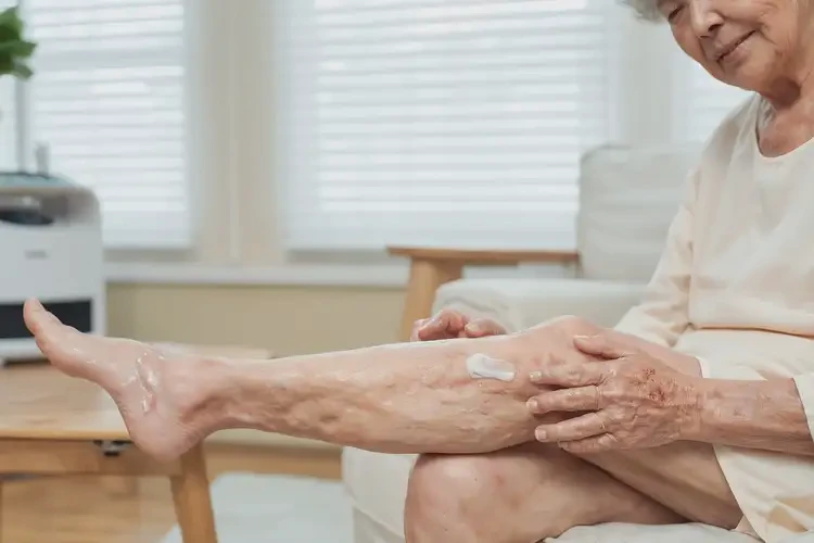 高齡老人小腿偶爾長(zhǎng)濕疹能徹底自愈嗎(圖1)