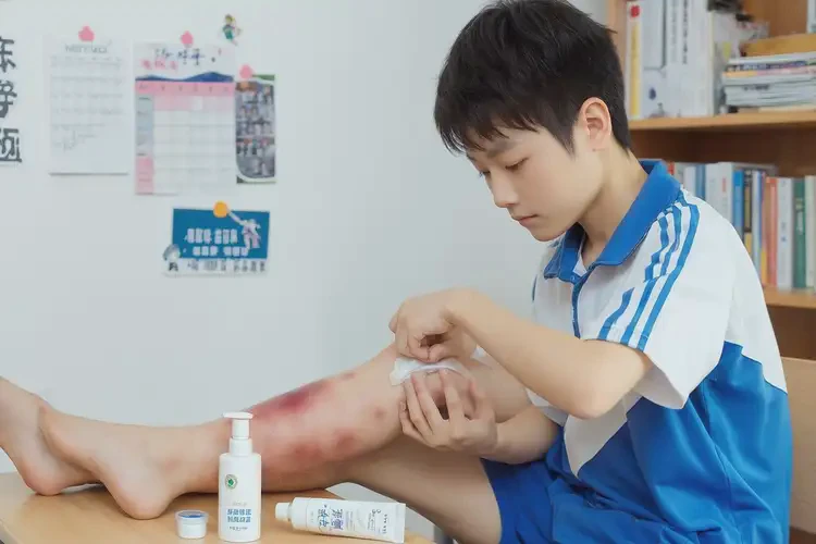 中學(xué)生小腿上經(jīng)常長濕疹能夠徹底治愈嗎(圖2)