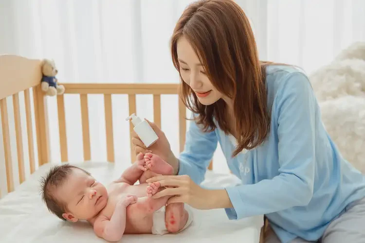 新生兒腳上偶爾起濕疹不管它會(huì)自己痊愈嗎(圖2)