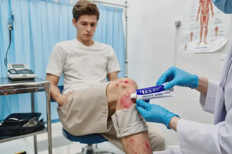 青年人小腿出濕疹不管它會(huì)自己痊愈嗎(圖3)