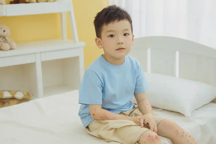 孩子肚子出現(xiàn)濕疹可以徹底自愈嗎(圖2)