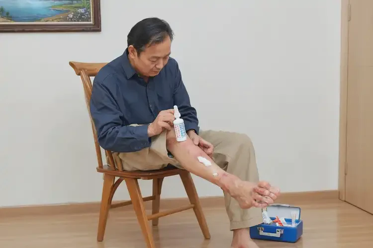 男人脚上偶尔起湿疹能不能彻底自愈(图3)