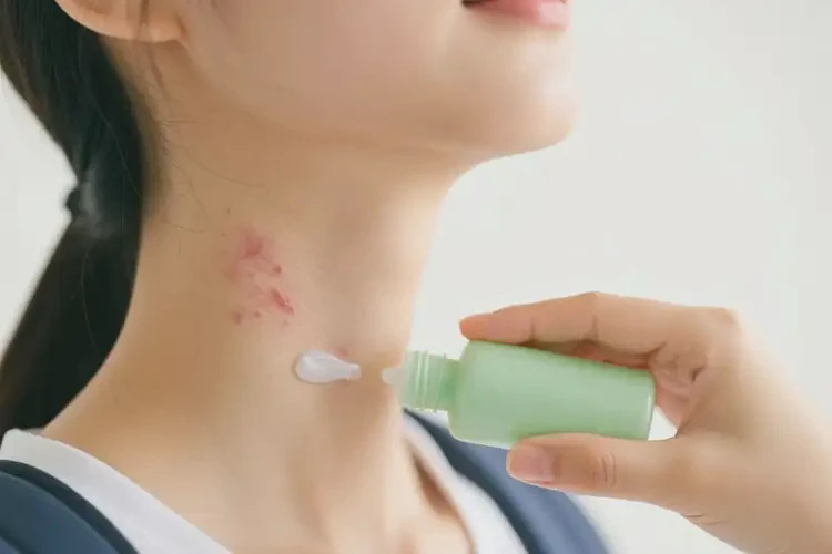 大學(xué)生脖子經(jīng)常長濕疹可不可以徹底自愈(圖3)