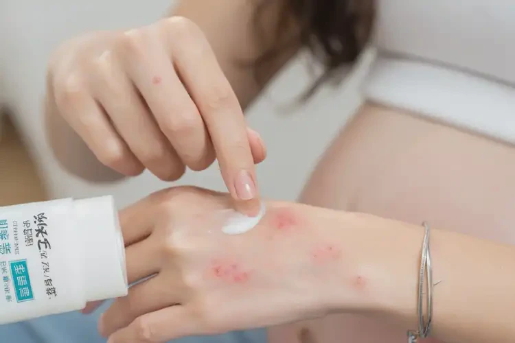 孕妇四肢经常起湿疹不管它会自己好吗(图4)