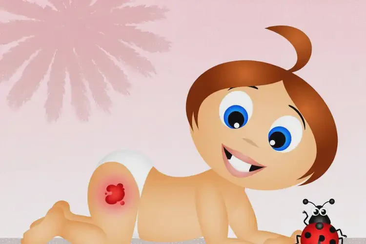 新生兒屁股上經(jīng)常長濕疹不管它會自己好嗎(圖2)