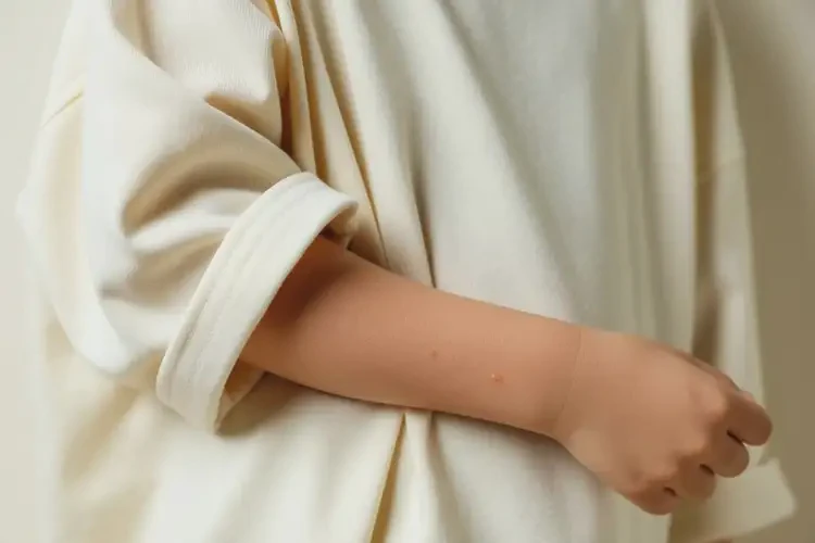 孩子手臂上起湿疹不管它会自己自愈吗(图2)