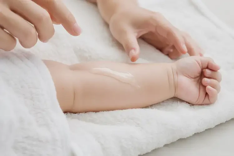 嬰兒手臂經(jīng)常長(zhǎng)濕疹可以徹底自愈嗎(圖2)