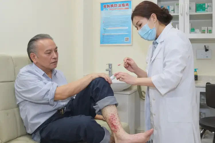 男人小腿上經(jīng)常長(zhǎng)濕疹不管它會(huì)自己好嗎(圖3)