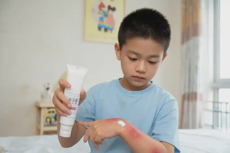 小學生手上容易長濕疹能靠自己自愈嗎(圖2)