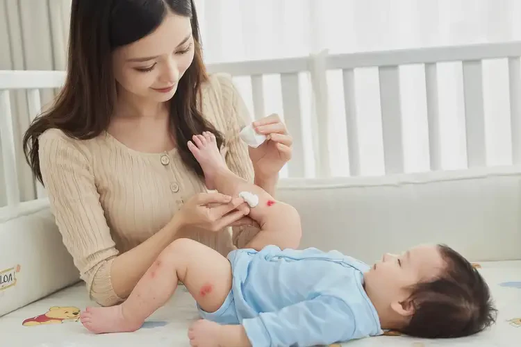 嬰兒大腿容易起濕疹不管它會(huì)自己自愈嗎(圖3)