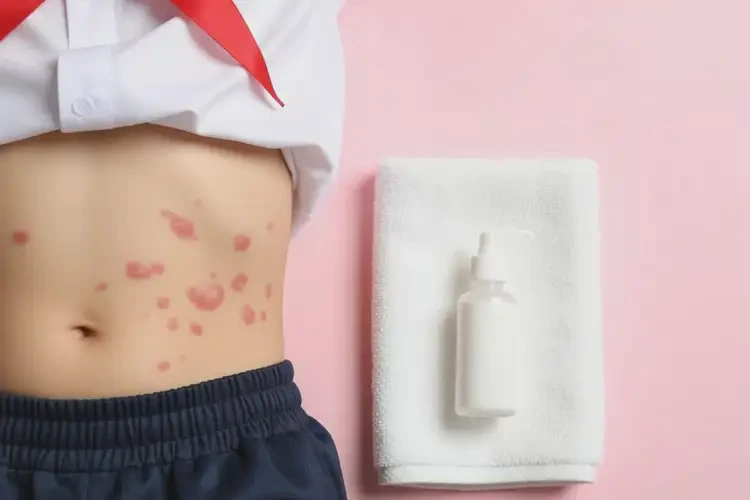 小學(xué)生肚子上偶爾長(zhǎng)濕疹能夠徹底治愈嗎(圖2)