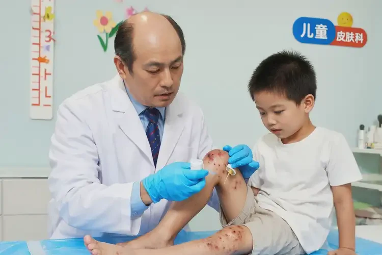 孩子大腿上经常起湿疹能彻底自愈吗(图3)