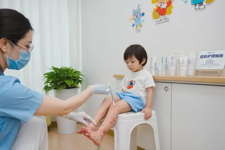 兒童腳上有濕疹不管它會自己好嗎(圖2)