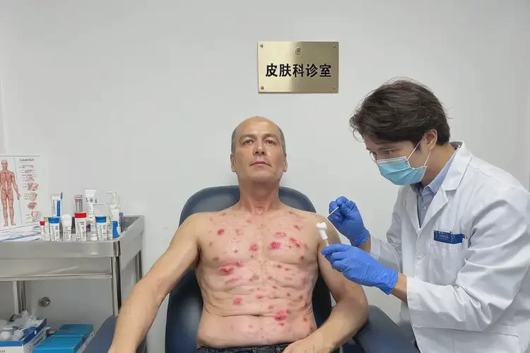 男性肚子起濕疹能夠徹底治愈嗎(圖3)