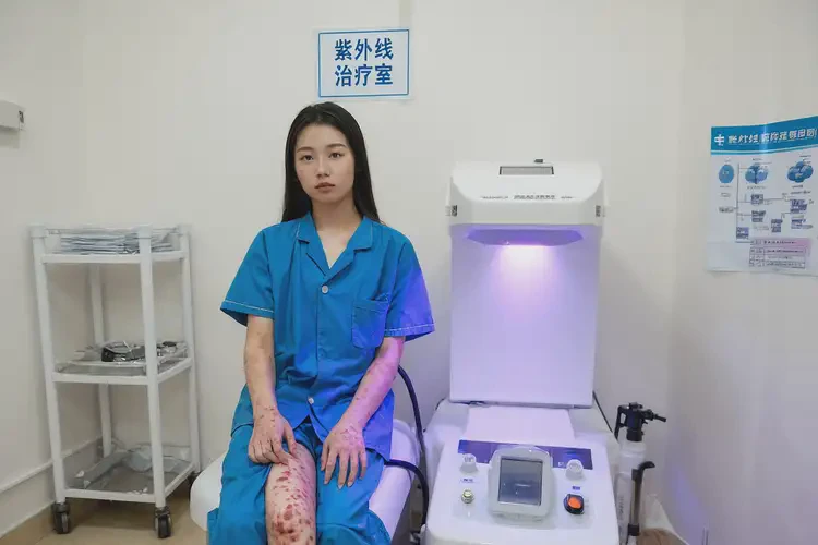 女人大腿有濕疹能徹底自愈嗎(圖1)