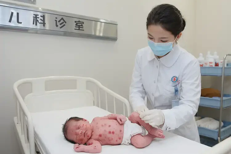 新生兒臉上起濕疹可以徹底自愈嗎(圖1)