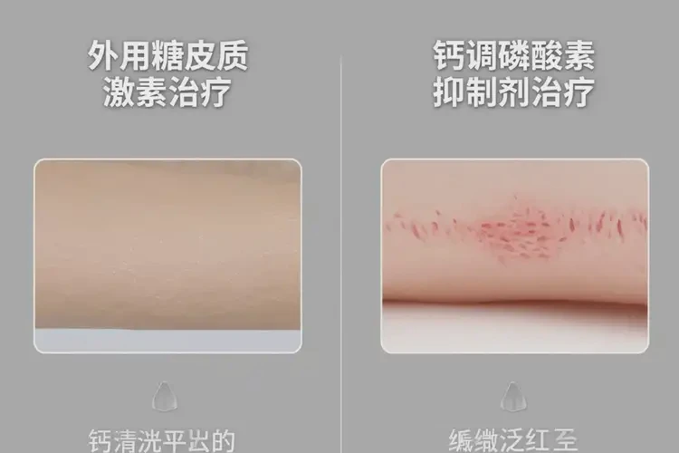 產(chǎn)婦腳上容易起濕疹可不可以徹底自愈(圖2)