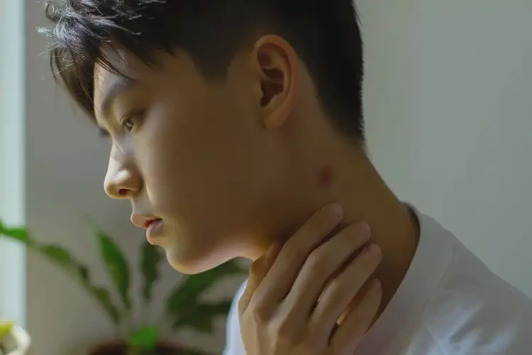 青少年脖子偶爾長(zhǎng)濕疹不管它會(huì)自己好嗎(圖4)