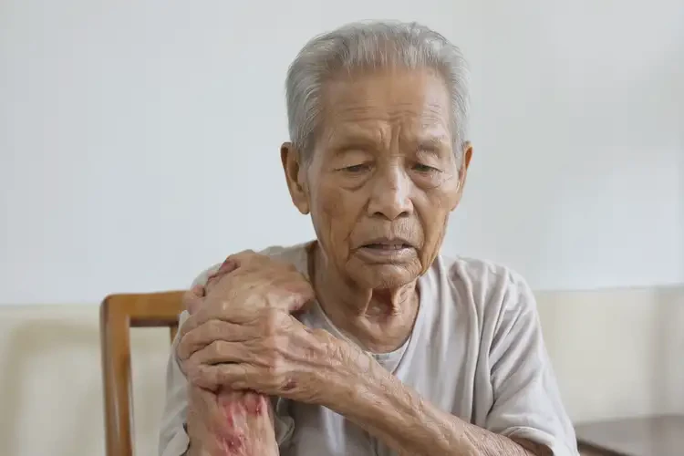 老人四肢經(jīng)常起濕疹不管它會自己好嗎(圖4)