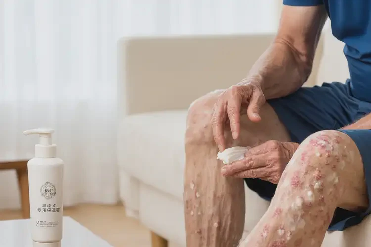 老年人大腿上有湿疹能不能彻底自愈(图3)