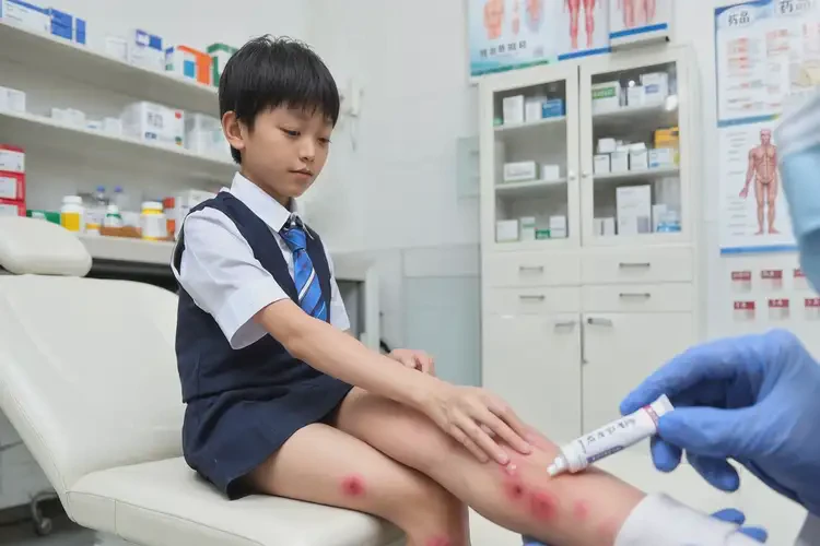 中學(xué)生小腿上經(jīng)常長濕疹能夠徹底治愈嗎(圖3)