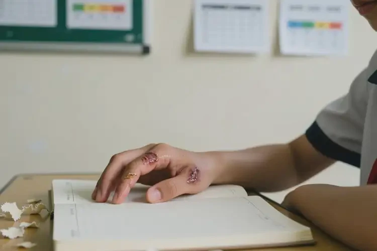 中學(xué)生手上出濕疹不管它會自己痊愈嗎(圖1)