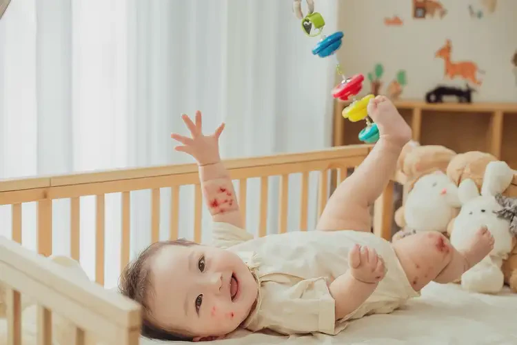 嬰兒手臂經(jīng)常長濕疹不管它會自己好嗎(圖2)