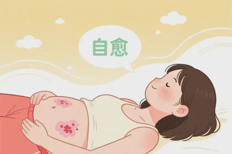 女生肚子長濕疹可不可以徹底自愈(圖2)