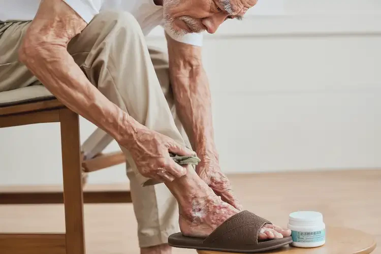 老年人脚上容易起湿疹不管它会自己好吗(图3)