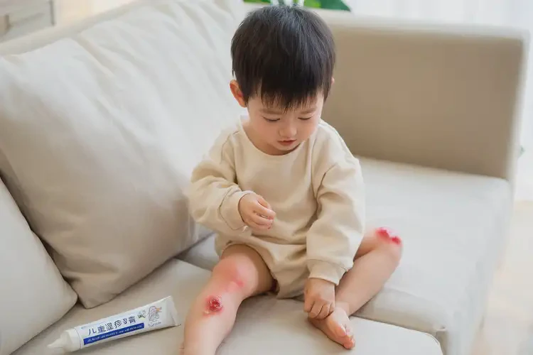 少兒大腿容易起濕疹不管它會自己好嗎(圖3)