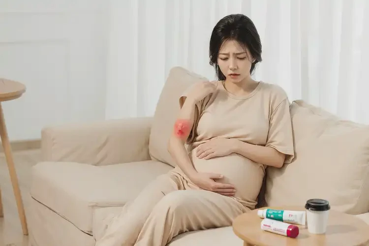 孕婦屁股偶爾長濕疹不管它會自己好嗎(圖4)