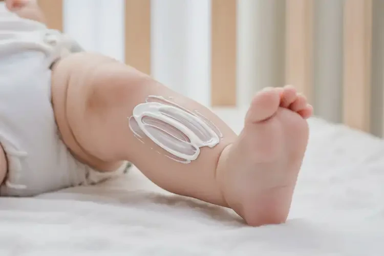 孩子大腿上偶爾起濕疹不管它會自己好嗎(圖2)