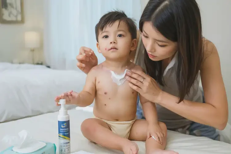 幼兒脖子上偶爾起濕疹不管它會(huì)自己痊愈嗎(圖2)