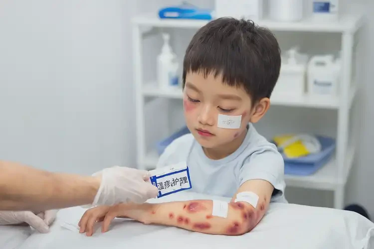 孩子全身容易起湿疹不管它会自己痊愈吗(图4)