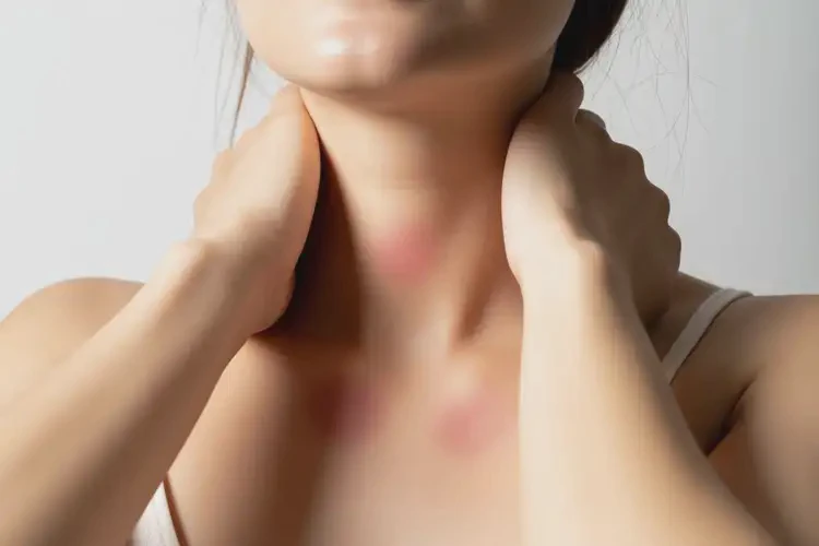 孕婦脖子上經(jīng)常長(zhǎng)濕疹不管它會(huì)自己自愈嗎(圖3)