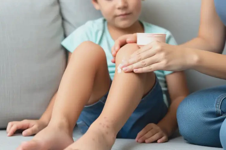 孩子小腿容易長(zhǎng)濕疹不管它會(huì)自己痊愈嗎(圖4)