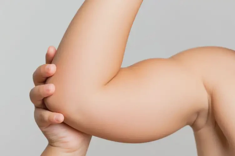 孩子手臂上起湿疹不管它会自己自愈吗(图4)